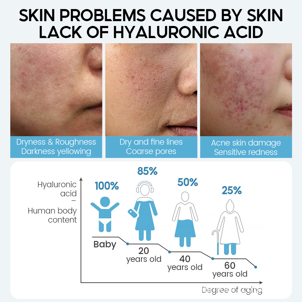 Hyaluronic Acid Face Serum Anti-Aging Shrink Pore Whitening Moisturizing Face Cream Dry Skin Care - Image 6